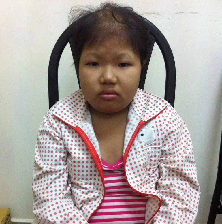 Bé Nguyễn Thị Quỳnh Như